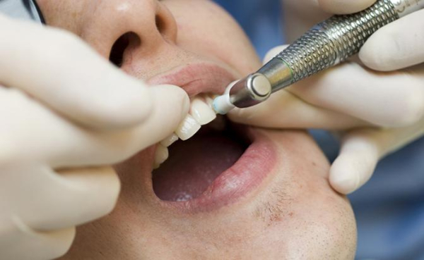 Врач рассказала, о чём может сигнализировать налёт на зубах Врач рассказала, о чём может сигнализировать налёт на зубах