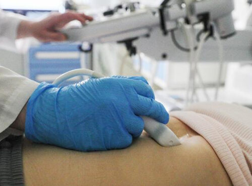 Назван признак, указывающий на высокий риск рака поджелудочной железы