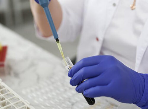 Ученые выявили точный способ предсказать риск ранней смерти Ученые выявили точный способ предсказать риск ранней смерти