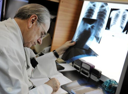 Врач-онколог объяснила, зачем проверять лёгкие после ковида