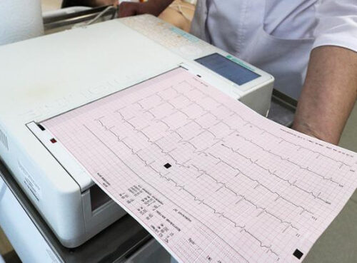 Инфаркт через три дня: Названы самые первые опасные сигналы