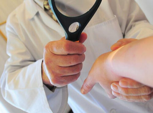 Врач рассказала о признаках опасного кожного заболевания Врач рассказала о признаках опасного кожного заболевания