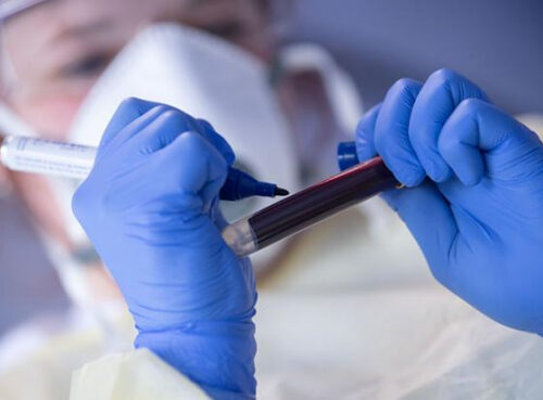 Врач назвала анализ крови, который нужно сдать после новогодних праздников